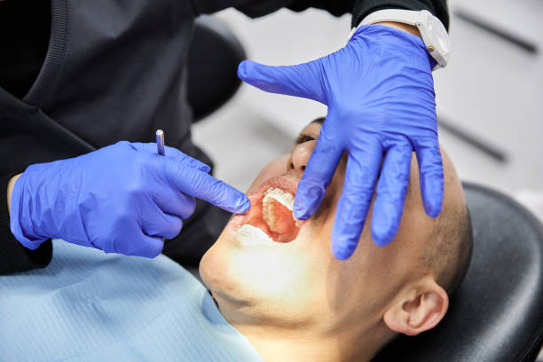 Best Urgent Tooth Repair  in Perry, GA